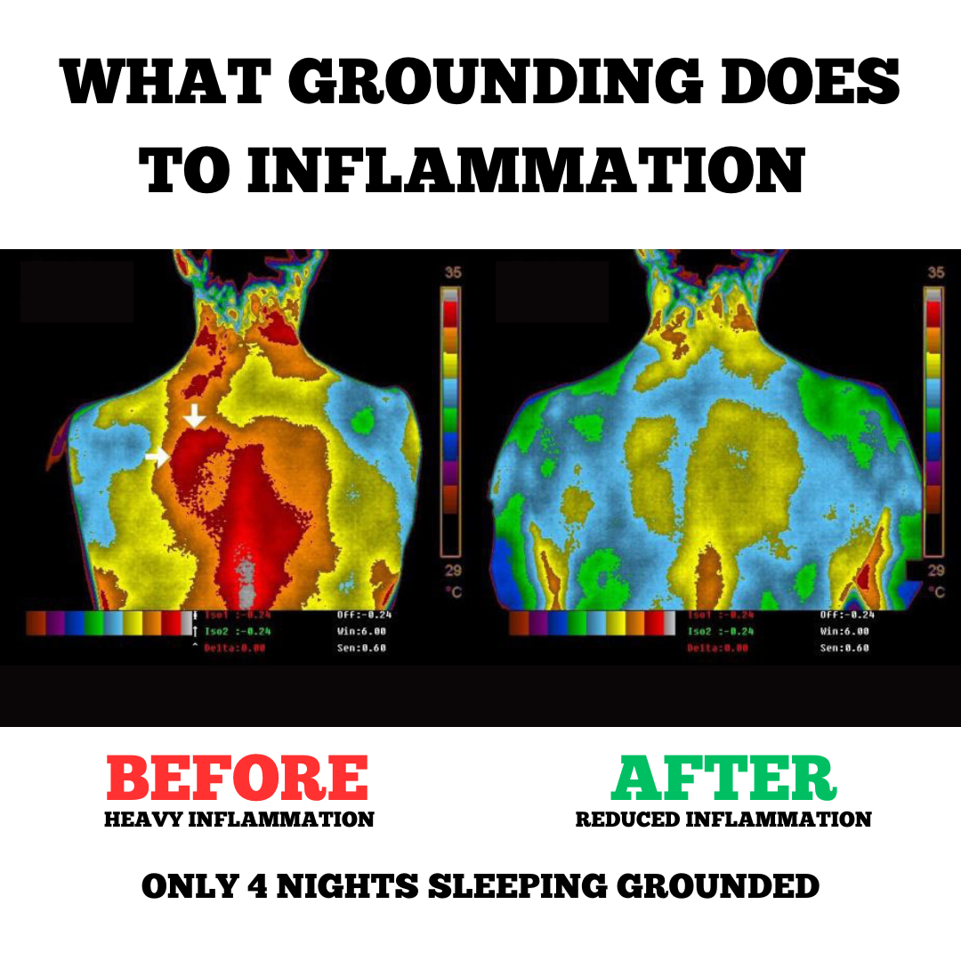 Before and after images demonstrating the reduction of inflammation due to using our grounding sheets, with the 'before' image showing noticeable redness and swelling and the 'after' image showing a clear and healthy skin appearance