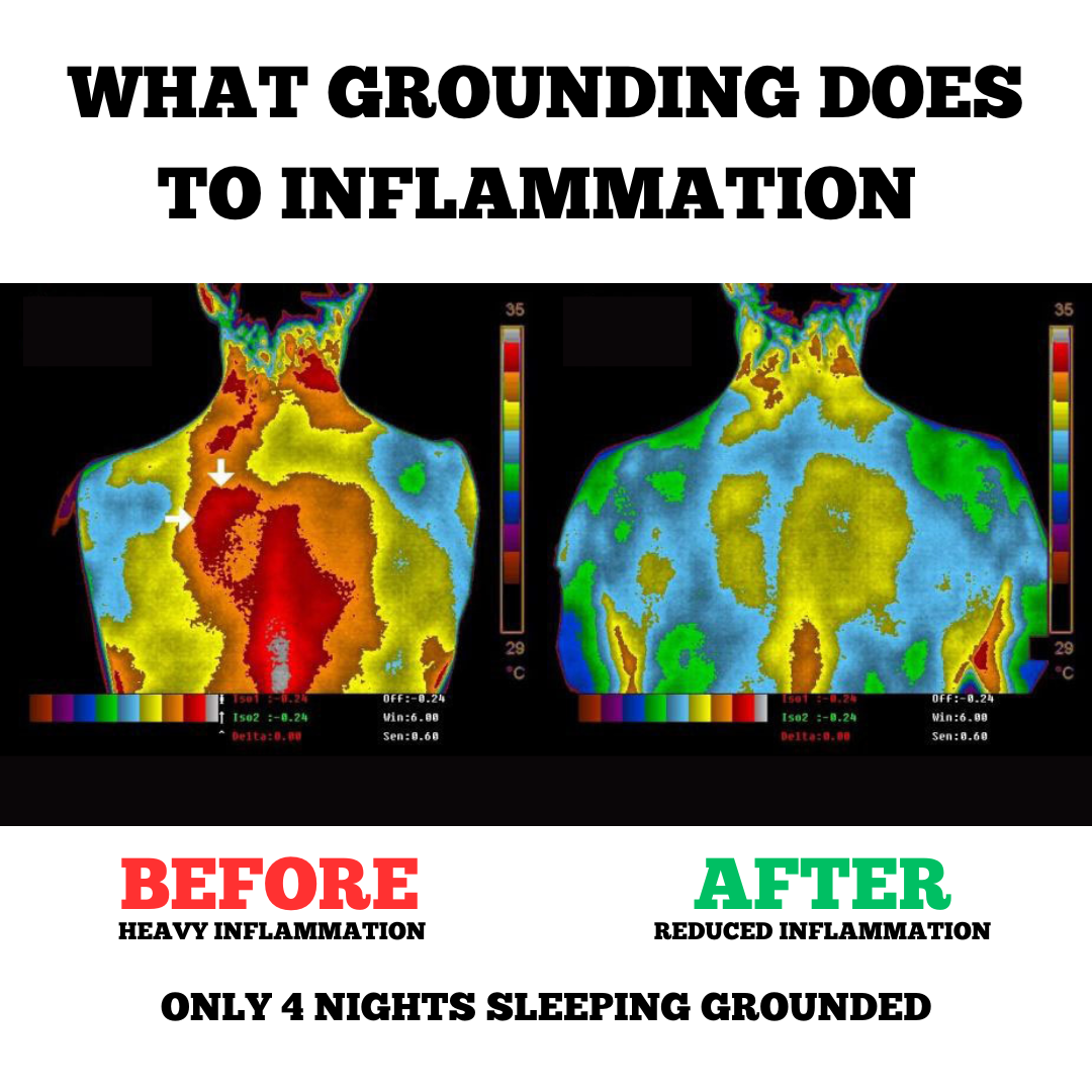 Before and after photos demonstrating the effects of grounding: the 'before' image shows visible inflammation with redness and swelling, while the 'after' image reveals a significant reduction in these symptoms, indicating the calming effects of using a grounding technique